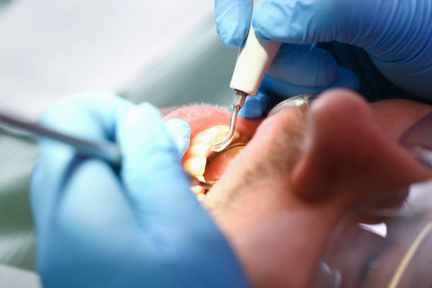 Best Pediatric Emergency Dentist in Jefferson, LA